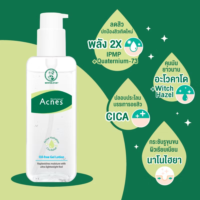 Mentholatum Acnes Oil-Free Gel Lotion 145ml – Clear, Hydrating Acne Treatment