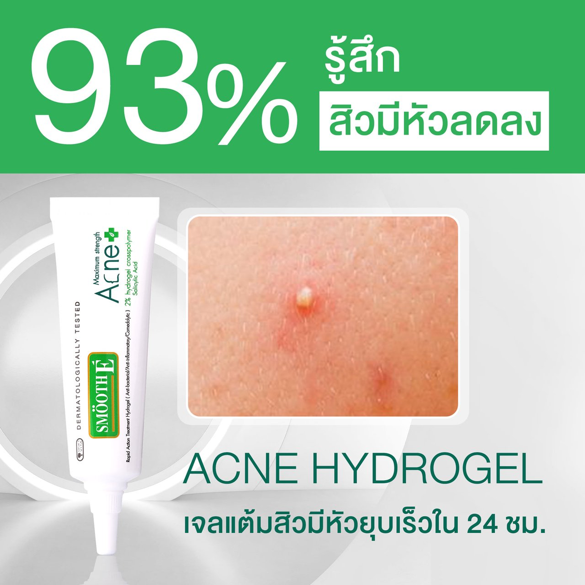 Smooth E Acne Scar Serum 7g - Effective Scar Treatment & Skin Rejuvenation