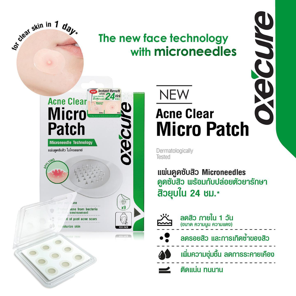 Oxe Cure Acne Clear Micro Patch - Fast-Acting Acne Treatment (9 Patches)