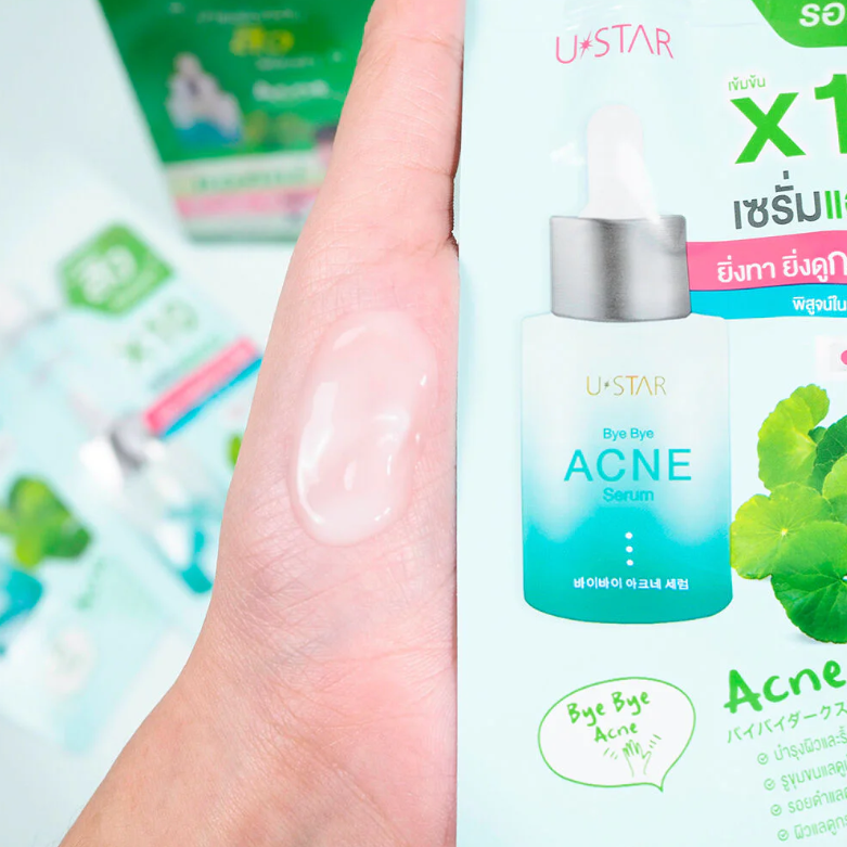 U-Star Bye Bye Acne Serum 5g – Pack of 3