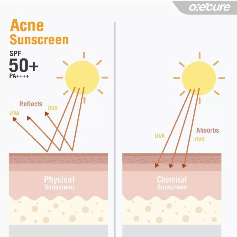 Oxe Cure Acne Sunscreen SPF 50+ PA++++ - Lightweight Gel-Cream for Sensitive & Acne-Prone Skin