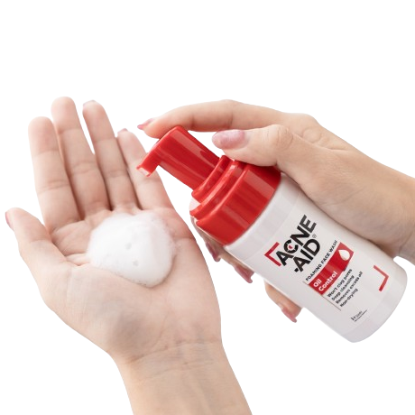 Acne-Aid Foaming Face Wash 100ml – Made in Thailand for Clear, Healthy Skin