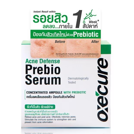 Oxe Cure Acne Defense Prebiotic Serum 20mg – Clear & Calm Skin
