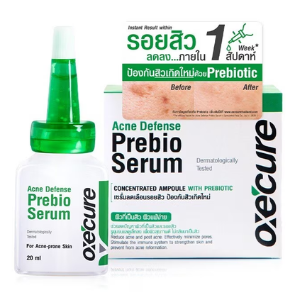 Oxe Cure Acne Defense Prebiotic Serum 20mg – Clear & Calm Skin