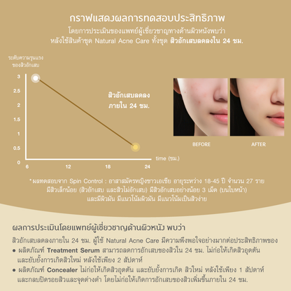 Oriental Princess Natural Acne Care Treatment Serum 30ml
