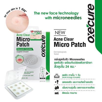Oxe Cure Acne Clear Micro Patch - Fast-Acting Acne Treatment (9 Patches)