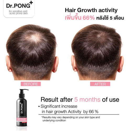 Dr. PONG Tsutsuji Gentle Shampoo 200ml – Nourishing Hair Loss Treatment