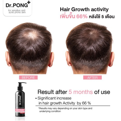 Dr. PONG Tsutsuji Gentle Shampoo 200ml – Nourishing Hair Loss Treatment