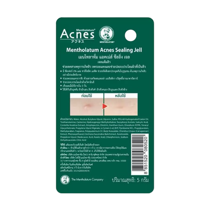 Mentholatum Acnes Sealing Gel 5g – Effective Acne Spot Treatment