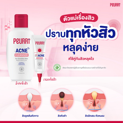 Peurri Acne Cleanser 100ml – Gentle Clarifying Formula for Oily & Sensitive Skin