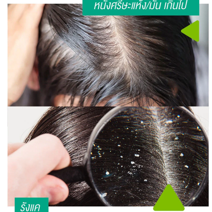 Smooth E Anti-Hair Loss Serum Spray 20ml – Nourish & Promote Thicker Hair