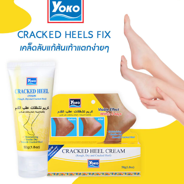 Yoko Cracked Heel Cream - 50g for Smooth, Healthy Feet