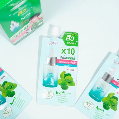 U-Star Bye Bye Acne Serum 5g – Pack of 3