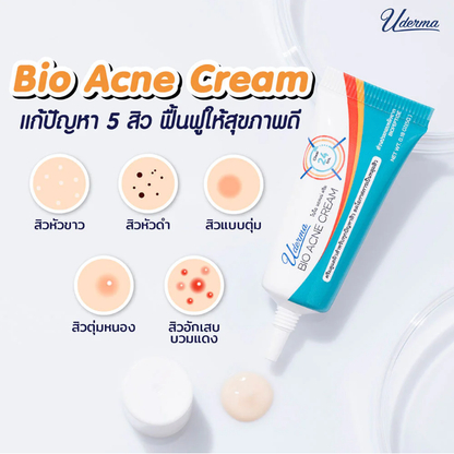 Uderma Bio Acne Cream - 5g | Clear Skin Solution