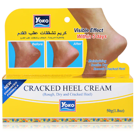 Yoko Cracked Heel Cream - 50g for Smooth, Healthy Feet