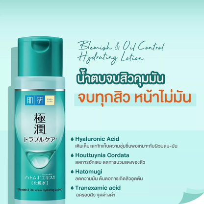 Hada Labo Blemish & Oil Control Hydrating Lotion 170ml – Clear, Balanced Skin