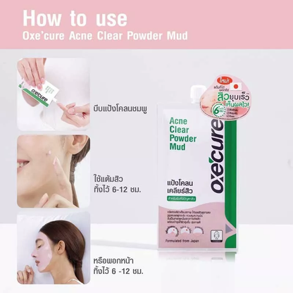 Oxe Cure Acne Clear Powder Mud 7g – Effective Blemish Treatment & Face Mask