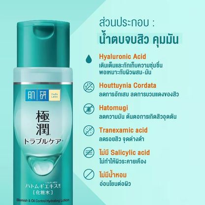 Hada Labo Blemish & Oil Control Hydrating Lotion 170ml – Clear, Balanced Skin